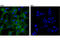 CD81 Molecule antibody, 10037S, Cell Signaling Technology, Immunocytochemistry image 
