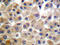 Platelet Derived Growth Factor Receptor Beta antibody, AP20313PU-N, Origene, Immunohistochemistry paraffin image 