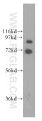 G Protein-Coupled Receptor Kinase 3 antibody, 13727-1-AP, Proteintech Group, Western Blot image 