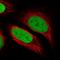 Protein Phosphatase, Mg2+/Mn2+ Dependent 1G antibody, NBP1-87245, Novus Biologicals, Immunocytochemistry image 
