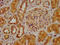 Cholinergic Receptor Nicotinic Beta 2 Subunit antibody, CSB-PA005396LA01HU, Cusabio, Immunohistochemistry frozen image 