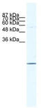 E2F Transcription Factor 6 antibody, TA330205, Origene, Western Blot image 
