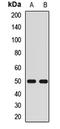 Potassium Voltage-Gated Channel Subfamily J Member 4 antibody, orb412727, Biorbyt, Western Blot image 