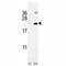 Interleukin-17F antibody, F41072-0.4ML, NSJ Bioreagents, Western Blot image 