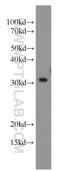 hMed6 antibody, 15338-1-AP, Proteintech Group, Western Blot image 