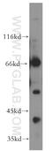Phosphate Cytidylyltransferase 1, Choline, Beta antibody, 13765-1-AP, Proteintech Group, Western Blot image 