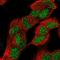 Zinc Finger Protein 184 antibody, HPA064793, Atlas Antibodies, Immunofluorescence image 