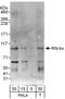 USP6 N-Terminal Like antibody, A302-794A, Bethyl Labs, Western Blot image 