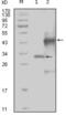 EPH Receptor A4 antibody, abx010723, Abbexa, Enzyme Linked Immunosorbent Assay image 