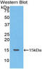 Tachykinin 3 antibody, LS-C700169, Lifespan Biosciences, Western Blot image 