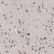 Tumor Protein P53 Inducible Nuclear Protein 1 antibody, HPA005856, Atlas Antibodies, Immunohistochemistry frozen image 