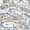 Charged Multivesicular Body Protein 2B antibody, 14-974, ProSci, Immunohistochemistry frozen image 