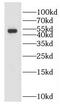 Galactokinase 2 antibody, FNab03320, FineTest, Western Blot image 