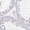 Calcium Voltage-Gated Channel Subunit Alpha1 S antibody, NBP2-33541, Novus Biologicals, Immunohistochemistry paraffin image 