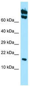 Heat Shock Protein Family B (Small) Member 11 antibody, TA333782, Origene, Western Blot image 