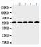 Mme antibody, PA2146, Boster Biological Technology, Western Blot image 
