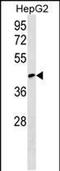 RCSD Domain Containing 1 antibody, PA5-48956, Invitrogen Antibodies, Western Blot image 