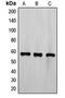 ETS Variant 6 antibody, MBS820801, MyBioSource, Western Blot image 