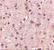 DLG Associated Protein 2 antibody, A09760, Boster Biological Technology, Immunohistochemistry paraffin image 
