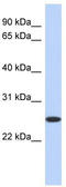 Biliverdin Reductase B antibody, TA335155, Origene, Western Blot image 