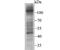 F-Box And Leucine Rich Repeat Protein 18 antibody, NBP2-75488, Novus Biologicals, Western Blot image 