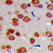 Inositol Polyphosphate-5-Phosphatase J antibody, LS-C356128, Lifespan Biosciences, Immunohistochemistry paraffin image 