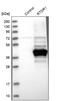 Radial Spoke Head 14 Homolog antibody, PA5-53796, Invitrogen Antibodies, Western Blot image 