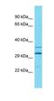 Telomere Repeat Binding Bouquet Formation Protein 1 antibody, orb326890, Biorbyt, Western Blot image 