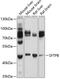 Pulmonary surfactant-associated protein B antibody, 16-955, ProSci, Western Blot image 