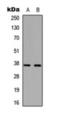 Palmitoyl-Protein Thioesterase 1 antibody, orb393136, Biorbyt, Western Blot image 