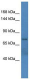 ADP Ribosylation Factor Guanine Nucleotide Exchange Factor 1 antibody, TA343164, Origene, Western Blot image 