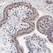 Ring-Box 1 antibody, HPA003038, Atlas Antibodies, Immunohistochemistry frozen image 