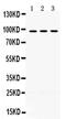 OPA1 Mitochondrial Dynamin Like GTPase antibody, PA5-79771, Invitrogen Antibodies, Western Blot image 