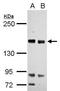 RAS Protein Activator Like 2 antibody, GTX120989, GeneTex, Western Blot image 