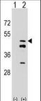 FPS antibody, LS-C166114, Lifespan Biosciences, Western Blot image 
