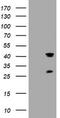 Transmembrane Protein 173 antibody, TA505021AM, Origene, Western Blot image 