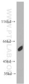 Cbl Proto-Oncogene Like 1 antibody, 21179-1-AP, Proteintech Group, Western Blot image 