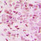 AT-Rich Interaction Domain 1B antibody, LS-C354185, Lifespan Biosciences, Immunohistochemistry paraffin image 