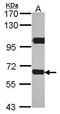 ATP-binding cassette sub-family D member 4 antibody, GTX114690, GeneTex, Western Blot image 