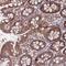 Coiled-Coil Domain Containing 184 antibody, NBP2-48747, Novus Biologicals, Immunohistochemistry frozen image 