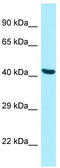 Pantothenate kinase 2, mitochondrial antibody, TA343335, Origene, Western Blot image 