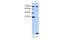 LSM2 Homolog, U6 Small Nuclear RNA And MRNA Degradation Associated antibody, PA5-41896, Invitrogen Antibodies, Western Blot image 