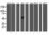 NADH:Ubiquinone Oxidoreductase Complex Assembly Factor 7 antibody, M12013-1, Boster Biological Technology, Western Blot image 
