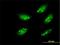 Mesenchyme Homeobox 1 antibody, H00004222-M01, Novus Biologicals, Immunocytochemistry image 