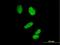 Cyclin H antibody, H00000902-B01P, Novus Biologicals, Immunocytochemistry image 
