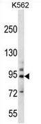 Protocadherin Beta 14 antibody, AP53209PU-N, Origene, Western Blot image 