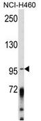 A-Kinase Anchoring Protein 3 antibody, AP17097PU-N, Origene, Western Blot image 