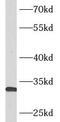 Ankyrin Repeat And SOCS Box Containing 8 antibody, FNab00624, FineTest, Western Blot image 