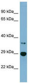 3-Hydroxybutyrate Dehydrogenase 2 antibody, TA344806, Origene, Western Blot image 