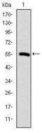 Chaperonin Containing TCP1 Subunit 2 antibody, NBP2-37553, Novus Biologicals, Western Blot image 